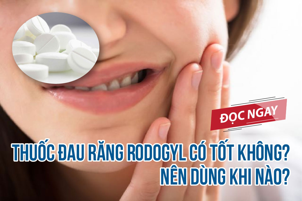 Thuốc đau răng rodogyl có tốt không? Nên dùng khi nào? 